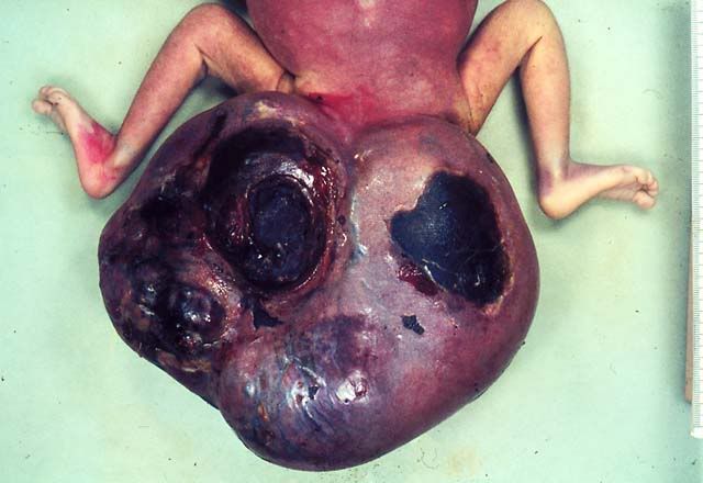 renal renal