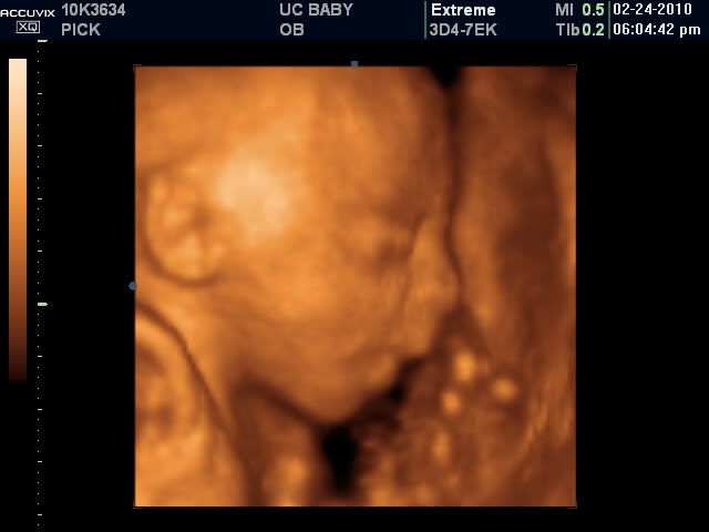 3d ultrasound 20 weeks pregnant. Had the 3D ultrasound today,